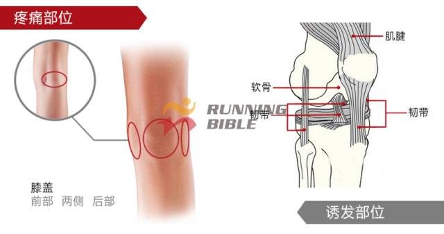 9种春训跑步膝伤，你该这样预防