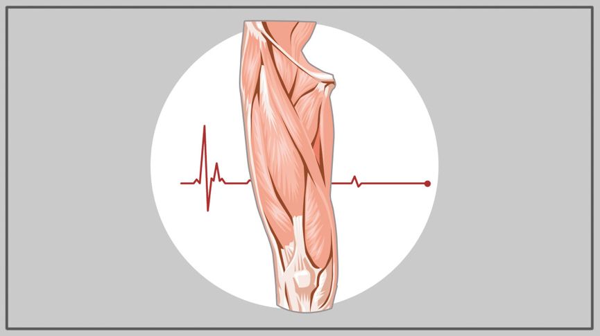 21图｜全面预防夏季跑步损伤！