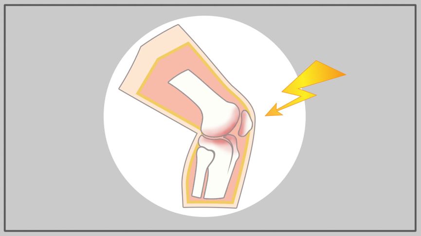 21图｜全面预防夏季跑步损伤！