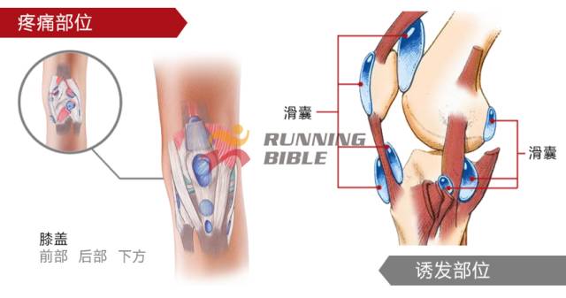 9种春训跑步膝伤，你该这样预防