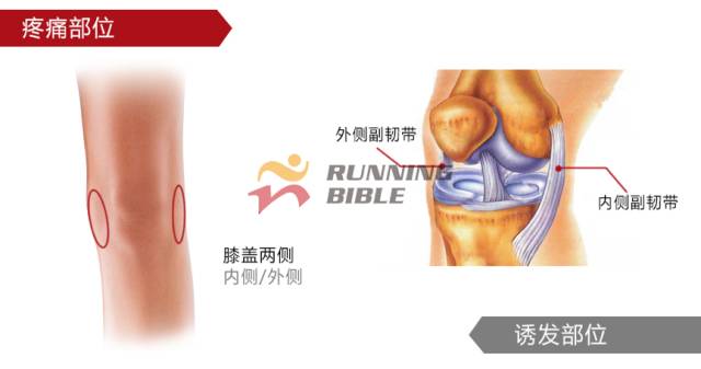 9种春训跑步膝伤，你该这样预防
