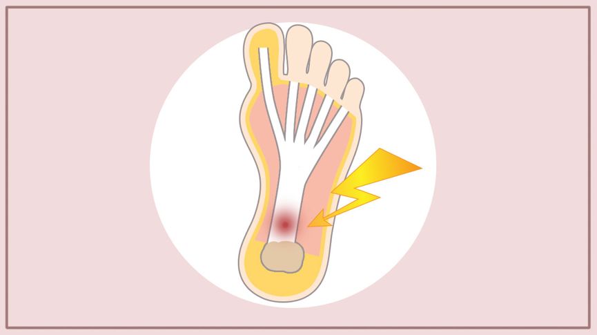 21图｜全面预防夏季跑步损伤！