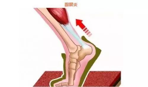 损伤预防：4个跟腱拉伸动作让你远离跟腱炎