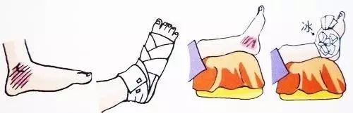 来领｜秋季跑步伤病预防宝典！