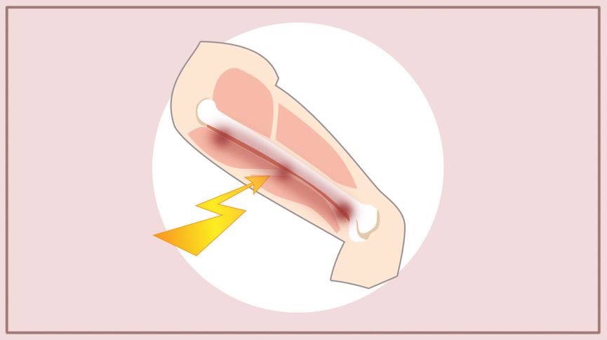 21图｜全面预防夏季跑步损伤！