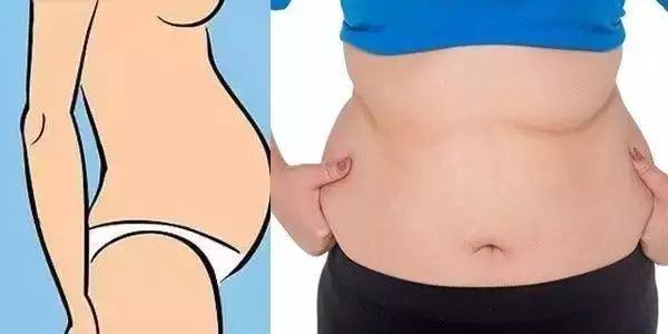 腰围＋BMI，两个指标判断是你什么肥胖类型！