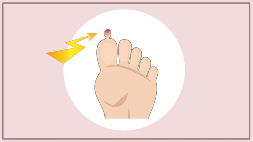 21图｜全面预防夏季跑步损伤！