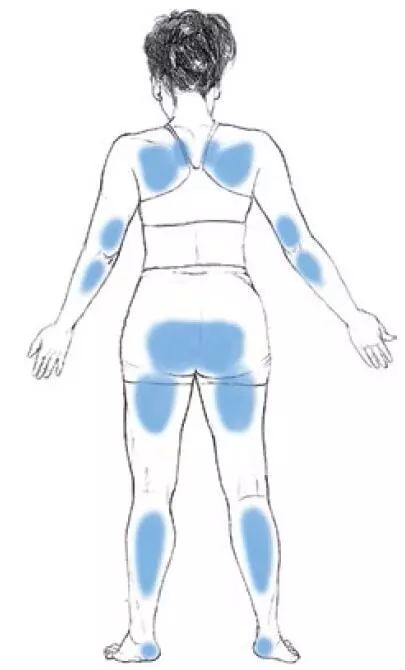 福利｜在家“摊尸”也健康？冬天运动就该这样做！