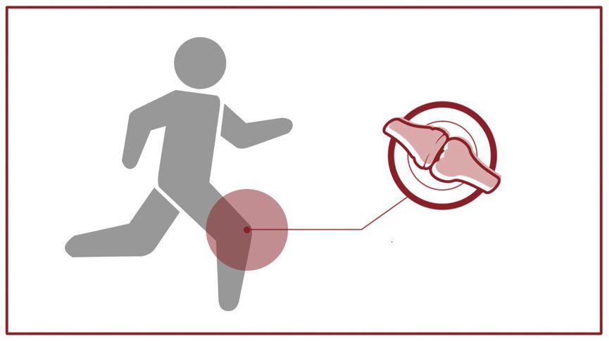 21图｜全面预防夏季跑步损伤！