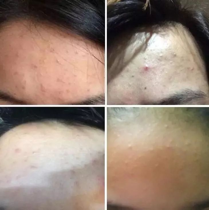 跑步运动时,汗水流到眼睛里怎么破?这款“导汗神器”全搞定! 跑步运动时,汗水流到眼睛里怎么破?这款“导汗神器”全搞定!