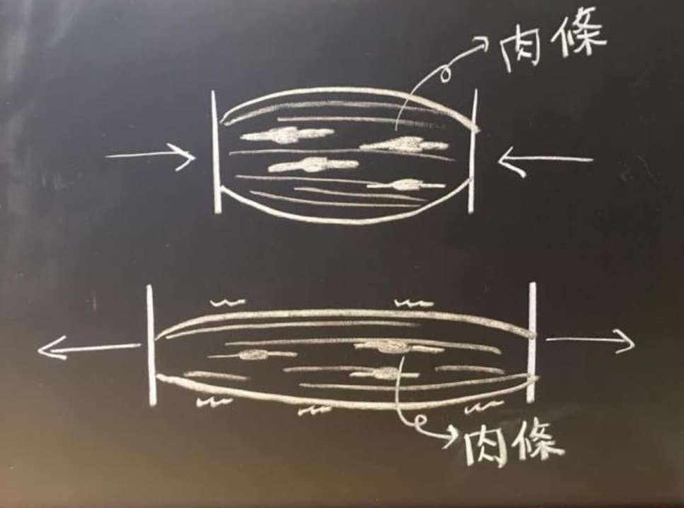 按摩、拉筋没效果？ 那是因为没有对症下药