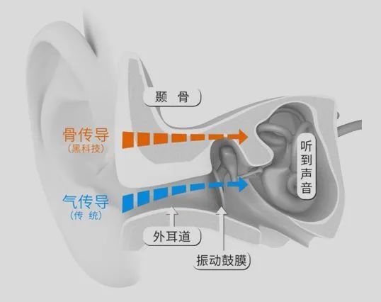 ​第一批 90 后，已经开始担心「耳聋」了！