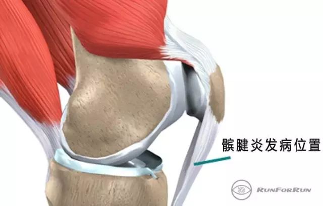 四种缓和训练，绝对不伤膝！