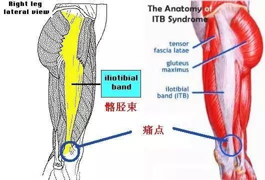 跑步七伤！早知道，早预防！